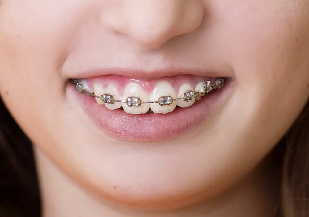 orthodontics