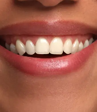 woman smiling