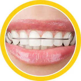 orthodontic retainers