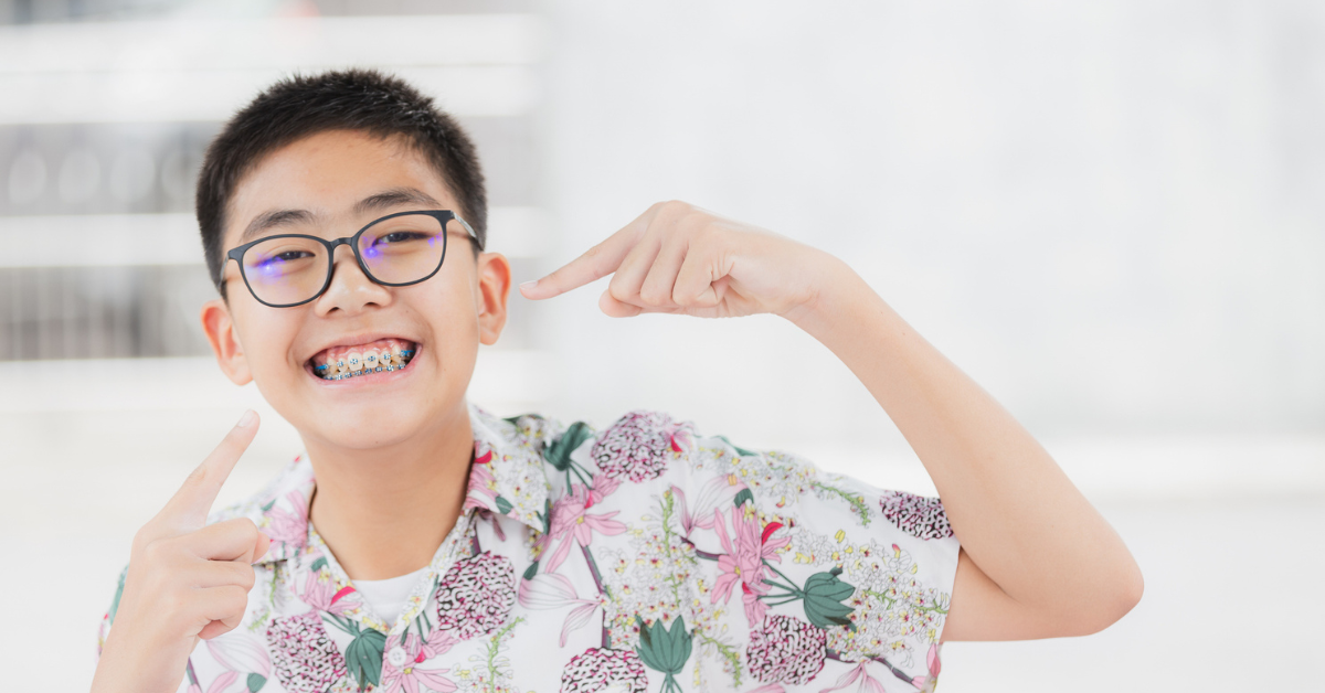 Overbites - Causes, Effects, and Treatment Options - Smile Brite Orthdontics