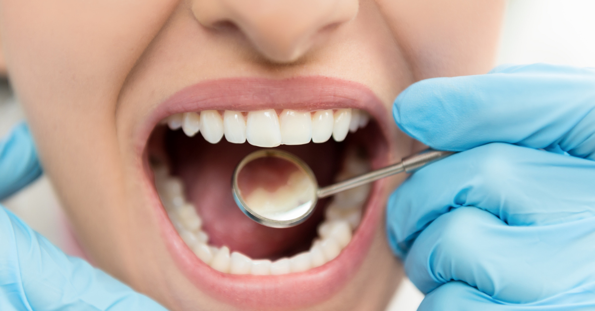 Enamel Wear Causes, Effects, and Treatment Options
