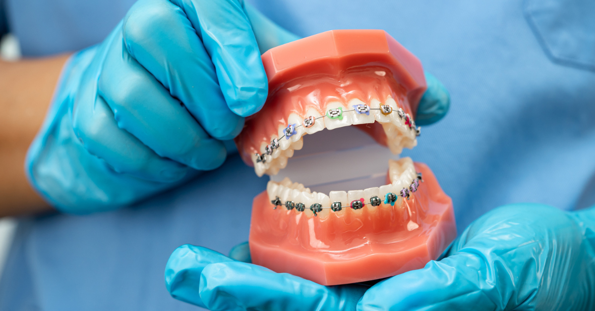Digital Imaging in Orthodontics How It Helps Diagnose and Plan Your Smile