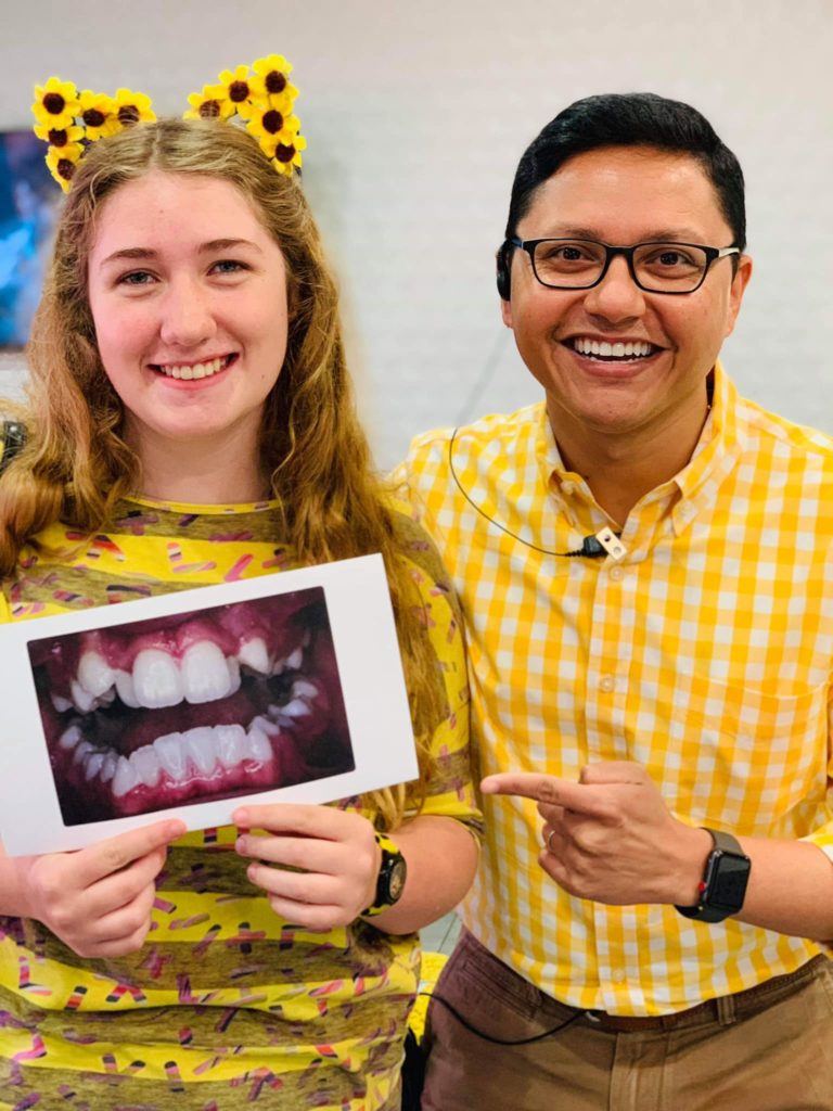 Smile Brite Orthodontics - Before and after