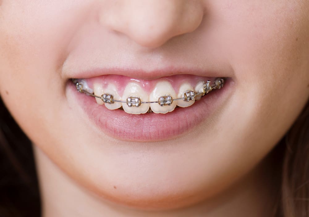orthodontics