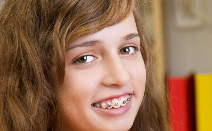 orthodontic treatment