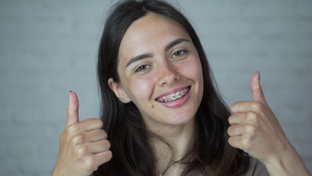 braces treatment