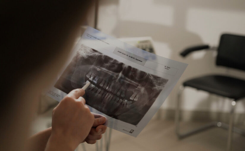 orthodontic treatment