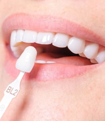 woman whitening teeth
