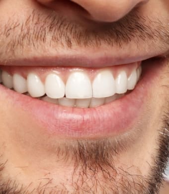 man smiling